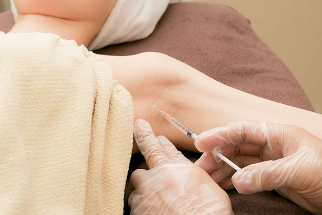 埼玉・越谷レイクタウンクリニック　ボトックス・ボツリヌストキシン注射による多汗症治療