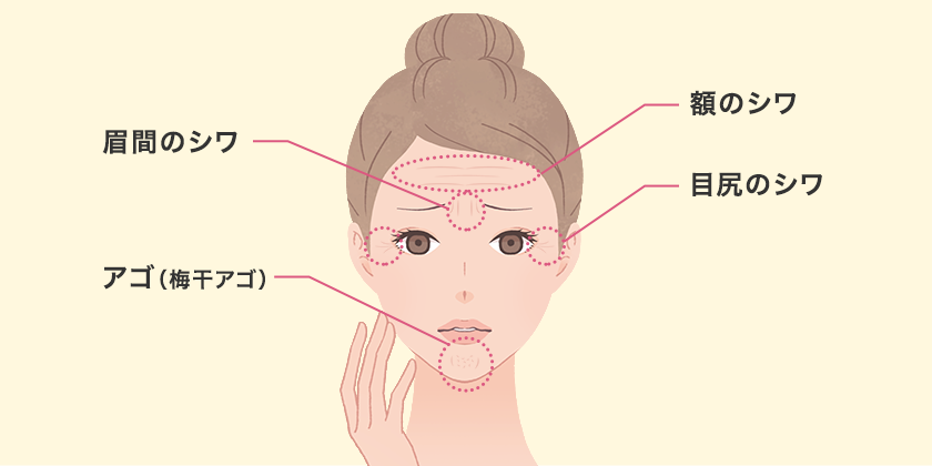 額・眉間・目尻・あごの表情ジワ