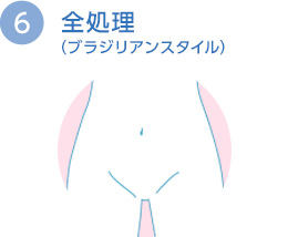 全処理（ブラジリアンスタイル）
