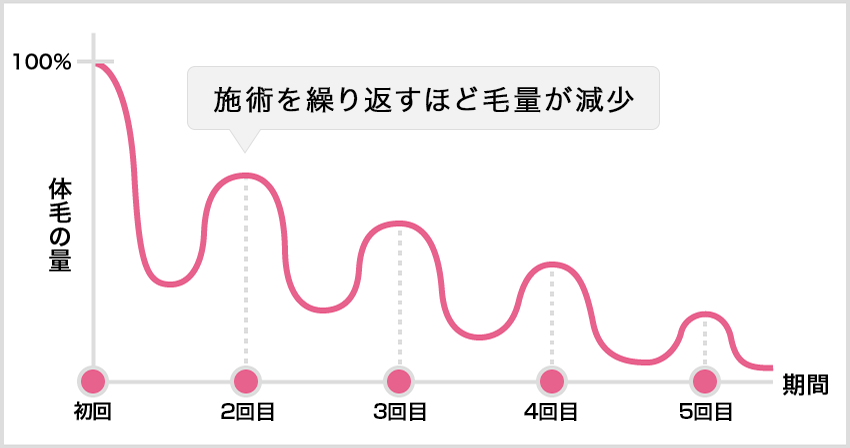 埼玉・越谷レイクタウンクリニックの医療脱毛は毛周期に合わせて照射