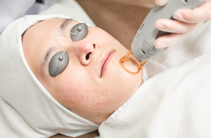 メンズ脱毛の施術風景