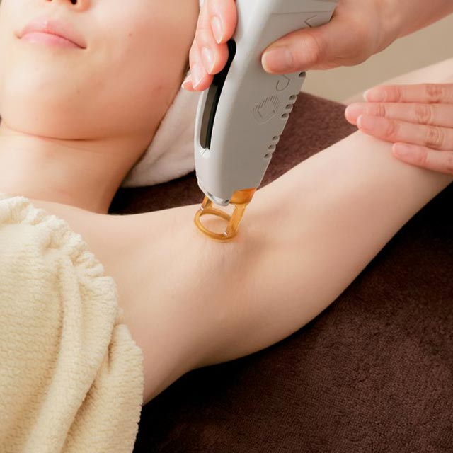 医療レーザー脱毛