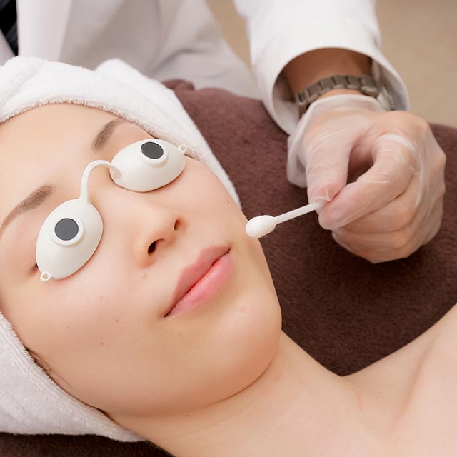 ケミカルピーリング