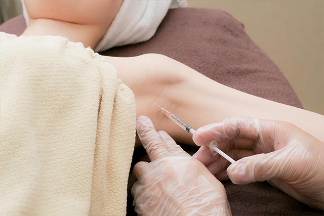 多汗症治療（ワキボトックス・ボツリヌストキシン注射）