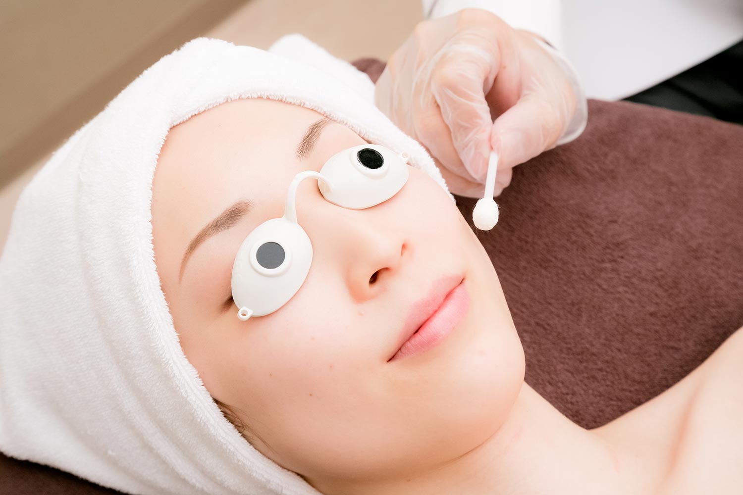 ケミカルピーリング