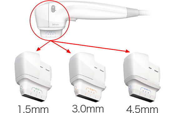 3種類のカートリッジを適切に組み合わせ