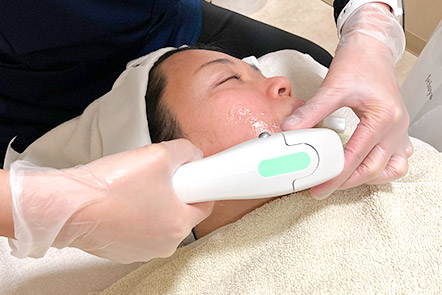 ウルトラセルキュープラスの施術