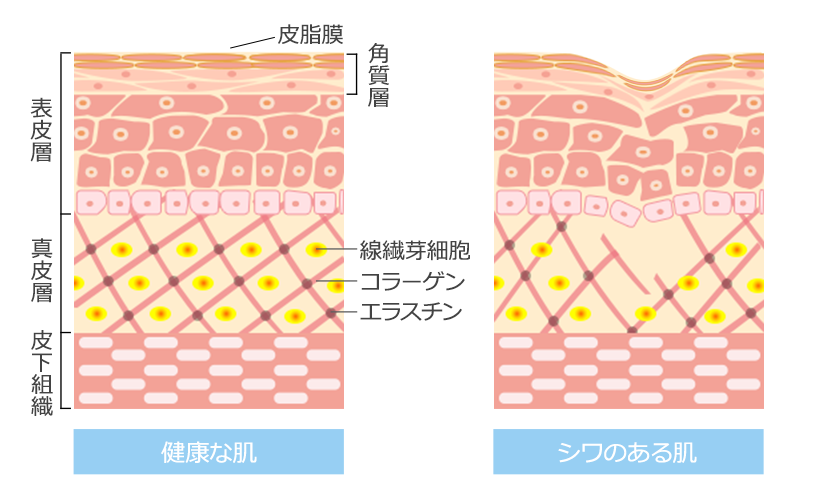 健康な肌とシワのある肌